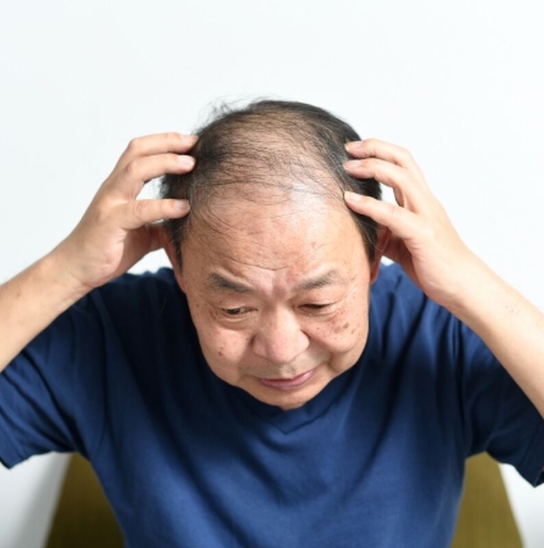 年配男性薄毛Sサイズ