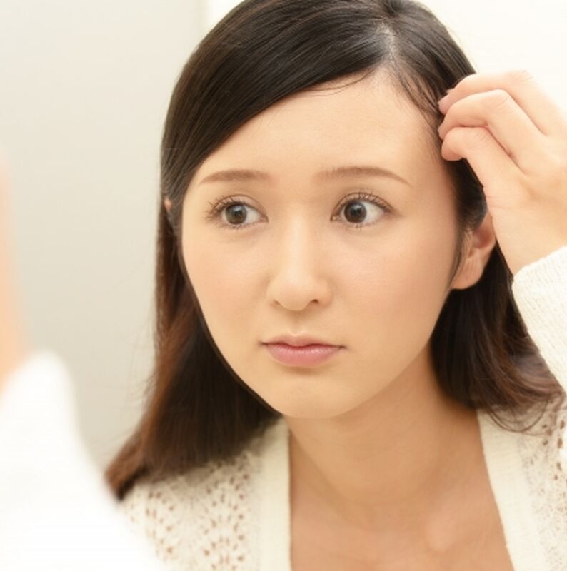 生え際が気になる女性Sサイズ